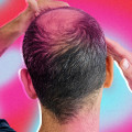 All About Hair Thickening Sprays: Preventing Baldness and Promoting Hair Growth