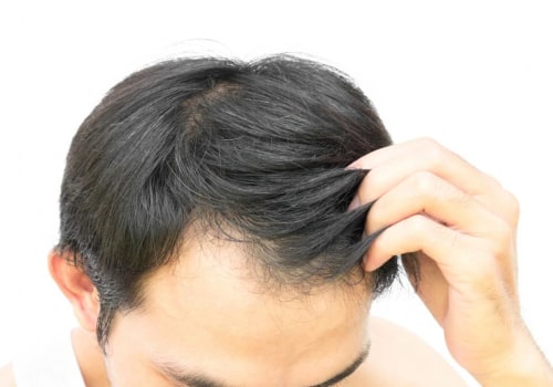 Conditioners for Hair Growth: Tips and Tricks to Prevent Baldness and Promote Hair Regrowth