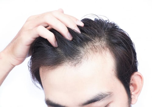 The Power of Vitamin D for Hair Growth